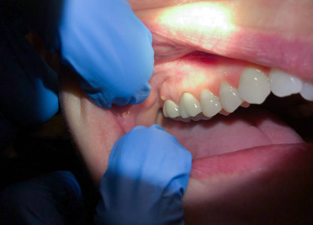 Best Emergency TMJ Treatment in Three Rivers, TX